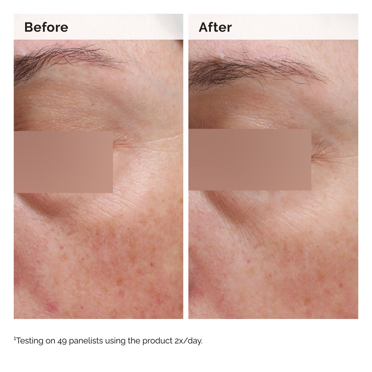 niacinamide-5-face-and-body-emulsion-d2 2024-08-23-ORD-Nia-5pct-Face-Body-B-A-Elasticity-Global-02-1x1.jpg
