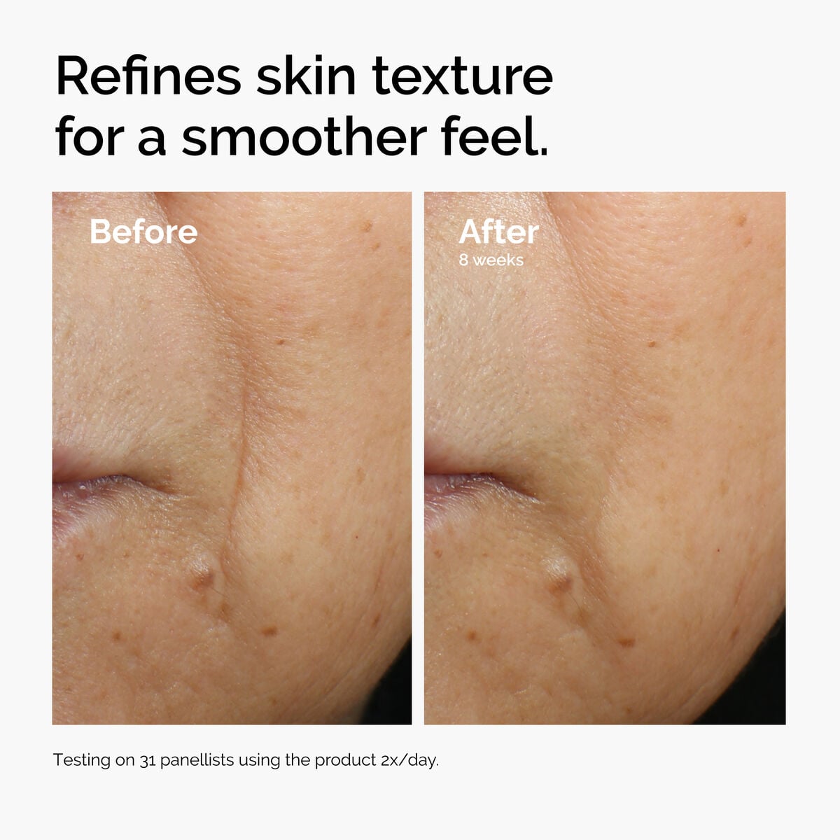 caffeine-3-escin-1-face-serum-g8 ord-caffeine-3pct-escin-1pct-face-serum-before-after-texture.jpg