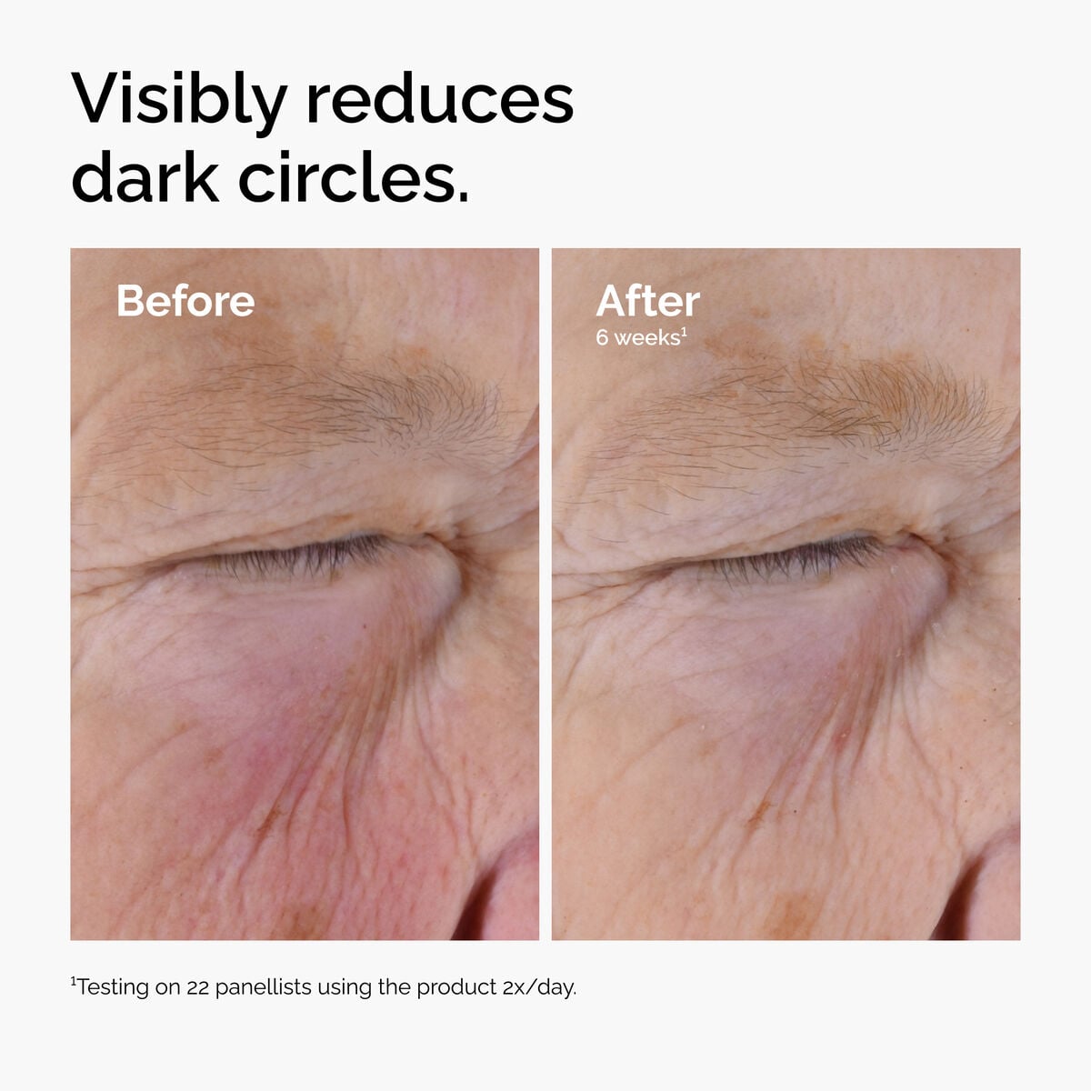 caffeine-solution-5-egcg-eye-serum-x8 ord-caffeine-solution-egcg-dark-circles-before-after.jpg