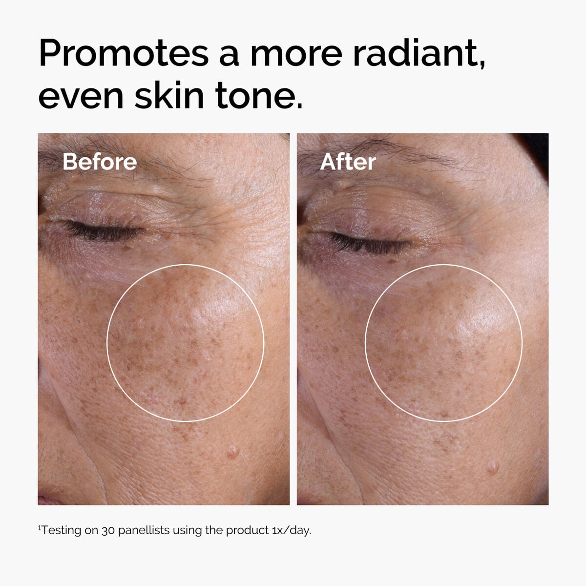 glycolic-acid-7-exfoliating-toner-d0 ord-glycolic-before-after-radiance.jpg