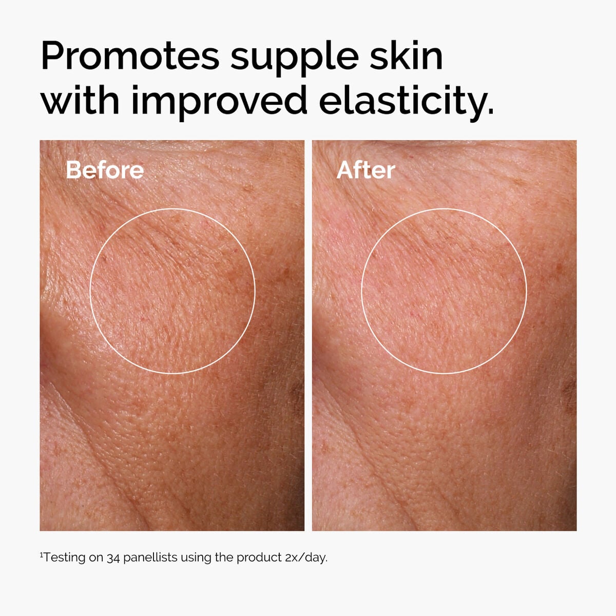 hyaluronic-acid-2-b5-with-ceramides-d4 ord-hyaluronic-acid-2pct-b5-hydrating-serum-before-after-elasticity.jpg