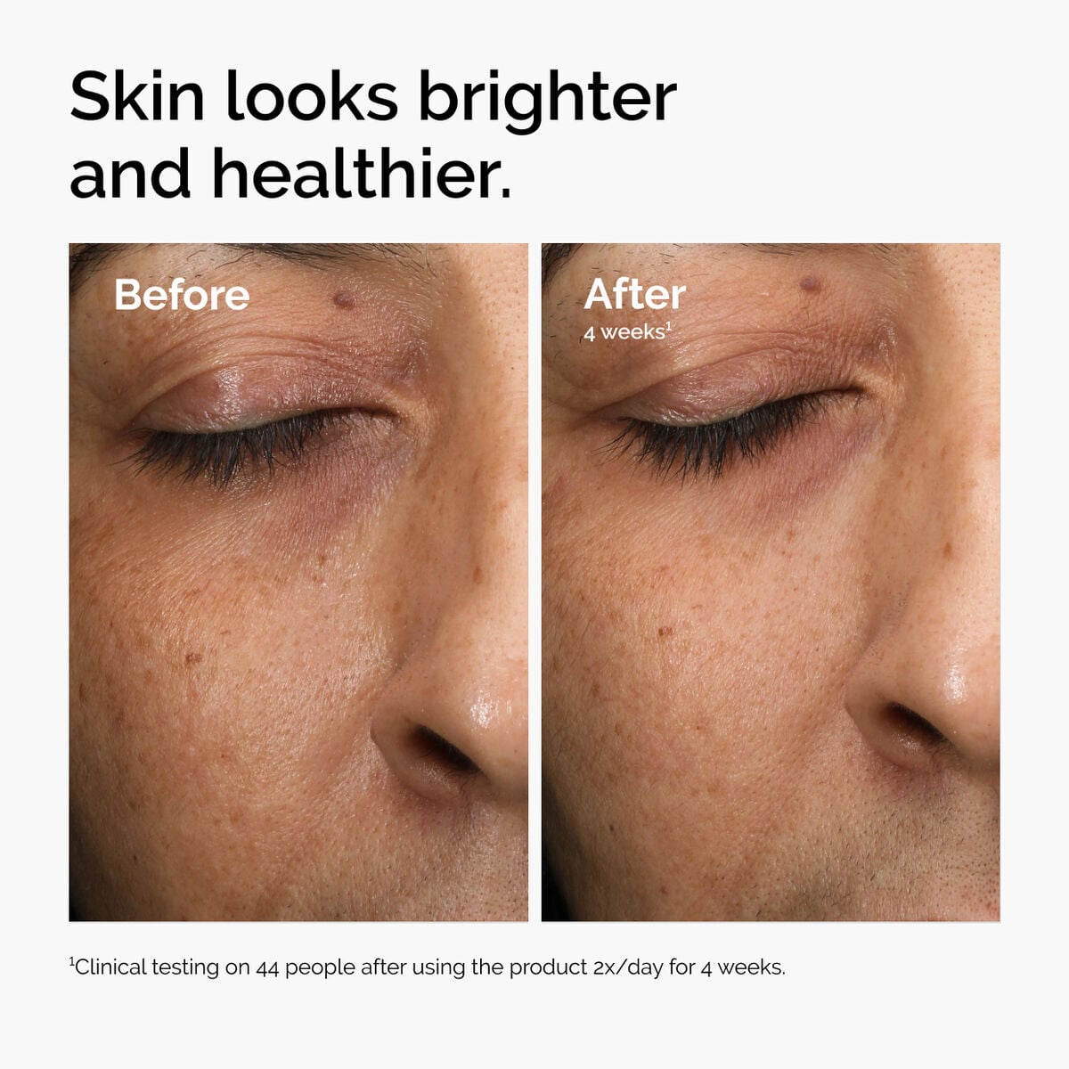multi-antioxidant-radiance-serum-z3 ord-mars-before-after-healthy.jpg