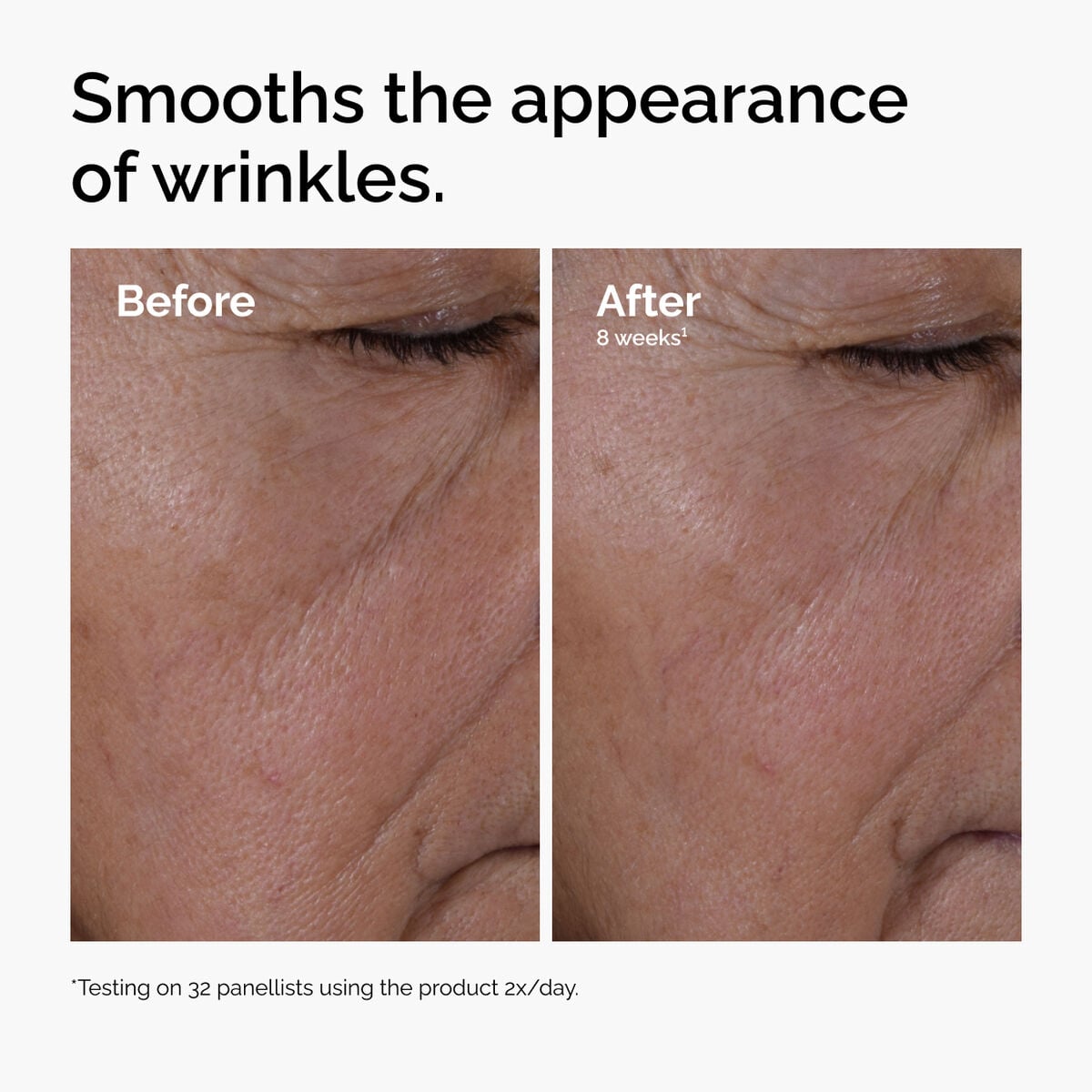 multi-peptide-ha-serum-t6 ord-multi-peptide-ha-serum-wrinkles-before-after.jpg