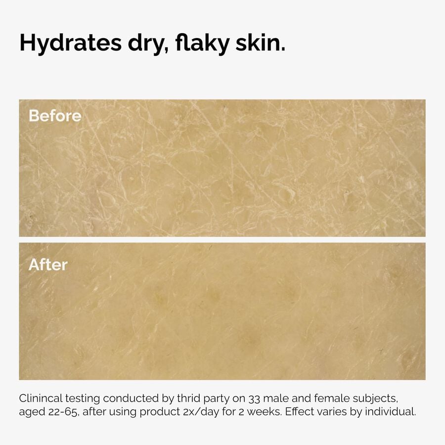 the-body-care-collection-y7 ord-natural-moisturizing-factors-inulin-body-before-after-graphic-02.jpg