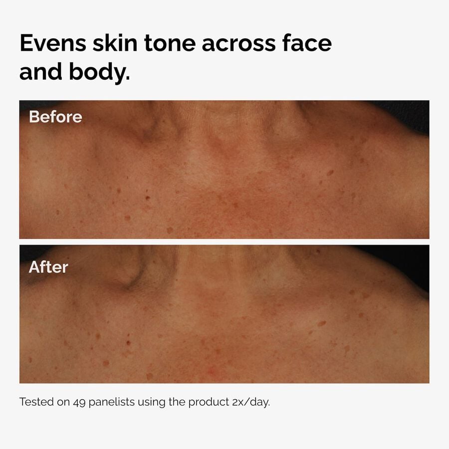 the-body-care-collection-y7 ord-niacinamide-face-body-serum-before-after-even-tone-graphic.jpg