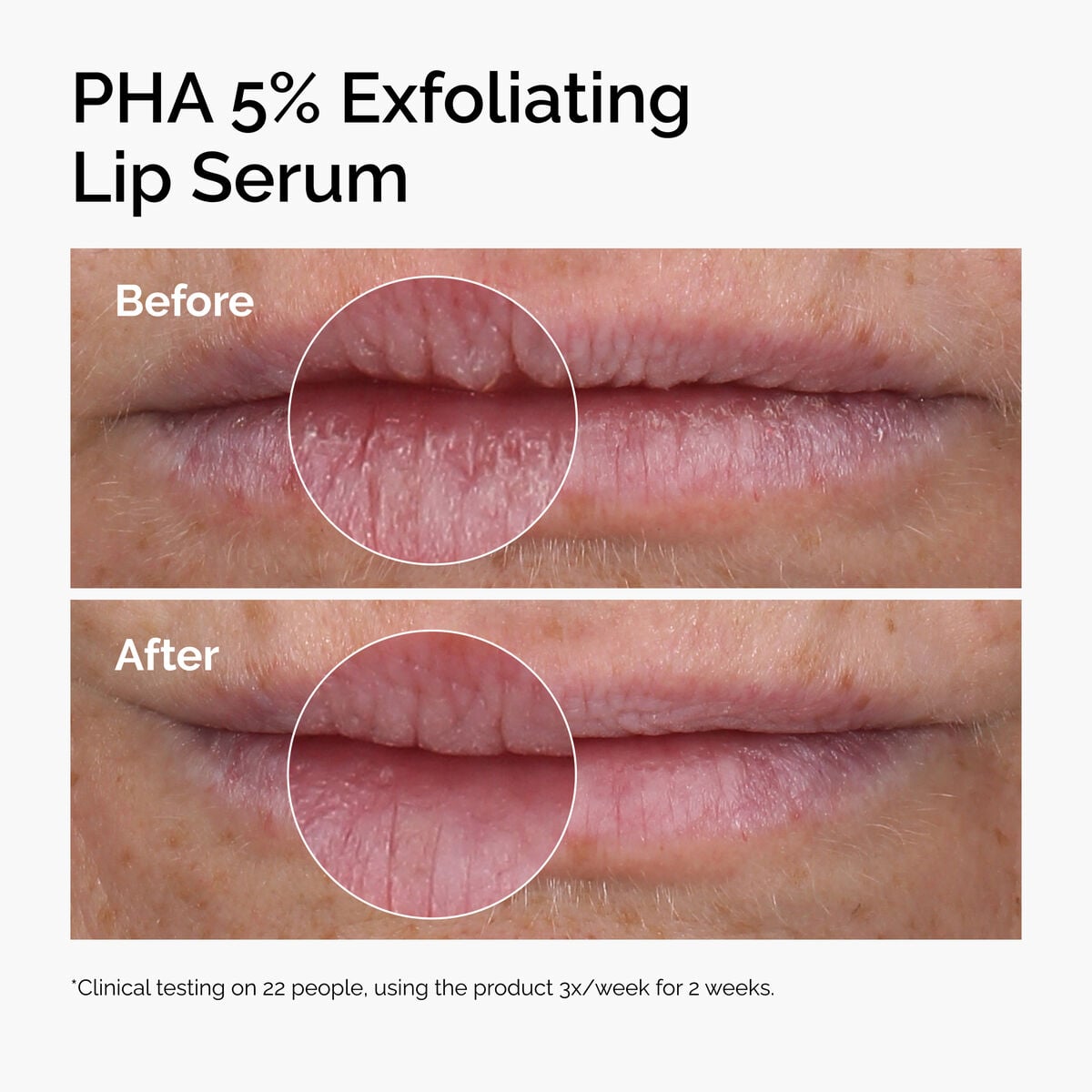 pha-5-exfoliating-lip-serum-t8 ord-pha-5pct-lip-exfoliating-serum-before-after.jpg